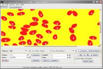 Captura GSA Image Analyser